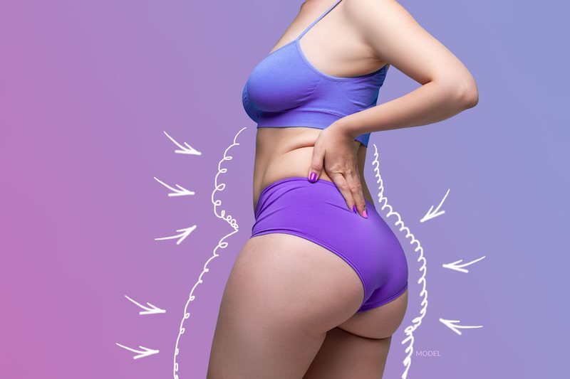 7 Procedures You Should Consider With or After Your Tummy Tuck to