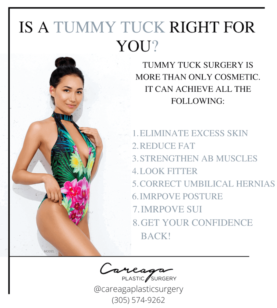 Unsure About Abdominoplasty? Learn the Top 10 Positives of Tummy Tuck  Surgery